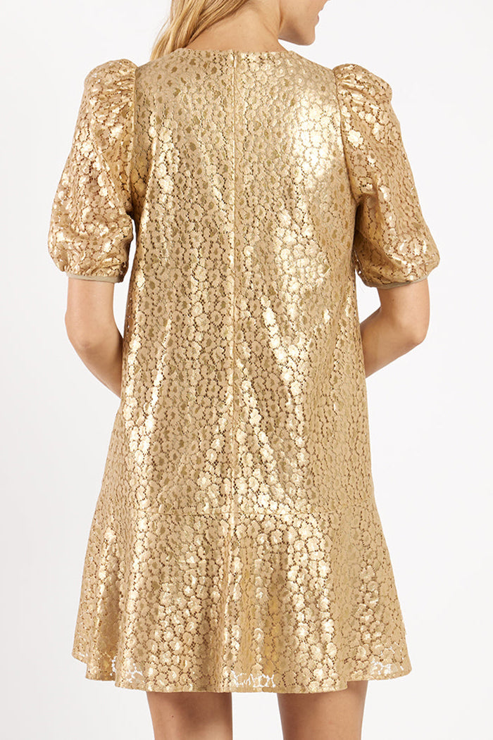 Casual Lace Detail Dress